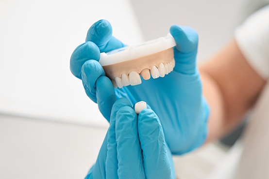 Laurel Bowie Implant and Cosmetic Dentistry | Implant Dentistry, All-on-X and Cosmetic Dentistry