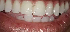 Laurel Bowie Implant and Cosmetic Dentistry | Laser Dentistry, Preventative Program and Cosmetic Dentistry