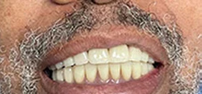 Laurel Bowie Implant and Cosmetic Dentistry | Root Canals, Implant Dentistry and Oral Exams