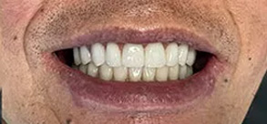 Laurel Bowie Implant and Cosmetic Dentistry | Emergency Treatment, Extractions and Digital Radiography