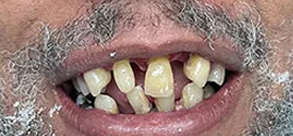 Laurel Bowie Implant and Cosmetic Dentistry | Veneers, Emergency Treatment and Night Guards