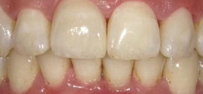 Laurel Bowie Implant and Cosmetic Dentistry | Veneers, Dentures and Cosmetic Dentistry