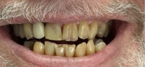 Laurel Bowie Implant and Cosmetic Dentistry | Root Canals, Implant Restorations and Laser Dentistry