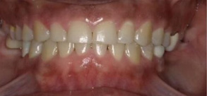 Laurel Bowie Implant and Cosmetic Dentistry | Emergency Treatment, Laser Dentistry and Dental Cleanings