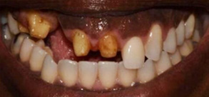 Laurel Bowie Implant and Cosmetic Dentistry | Digital Radiography, All-on-X and Preventative Program