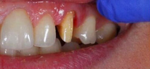 Laurel Bowie Implant and Cosmetic Dentistry | Dental Cleanings, All-on-X and Emergency Treatment