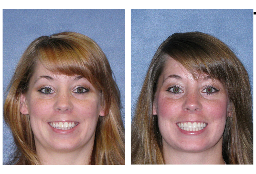 Laurel Bowie Implant and Cosmetic Dentistry