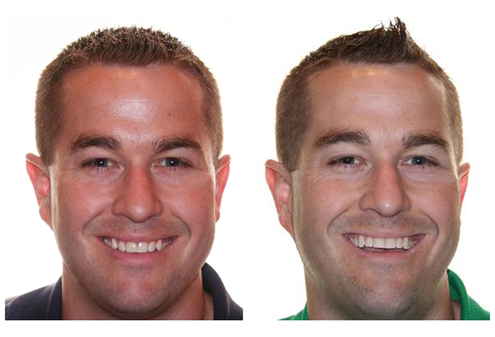 Laurel Bowie Implant and Cosmetic Dentistry