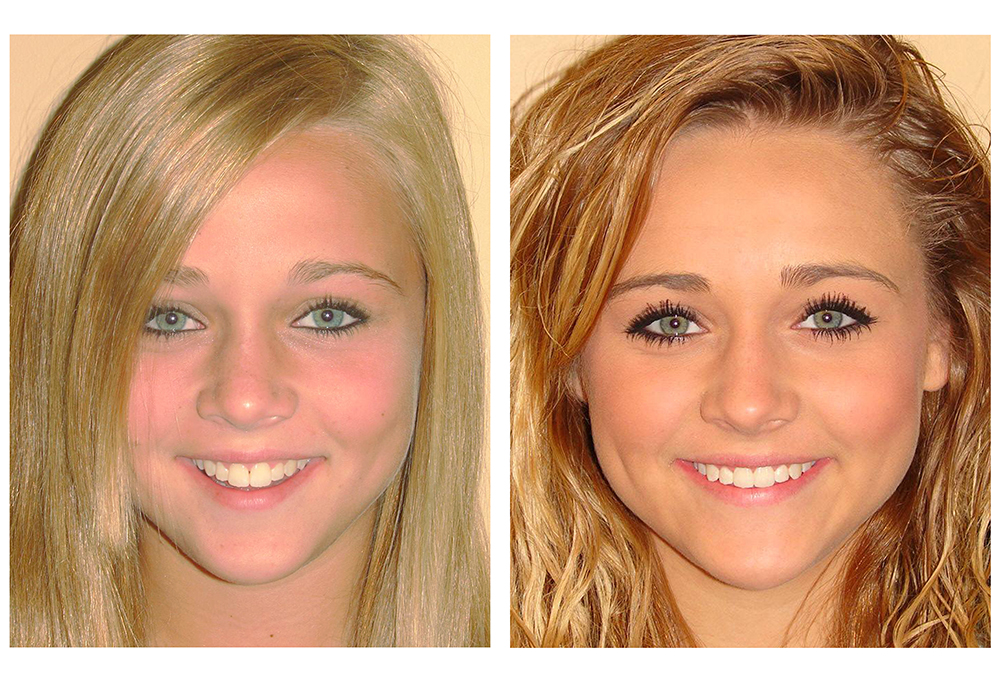 Laurel Bowie Implant and Cosmetic Dentistry