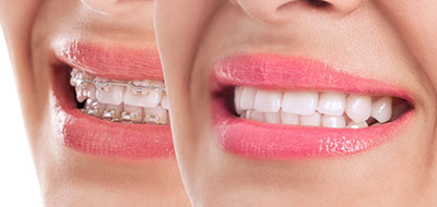Laurel Bowie Implant and Cosmetic Dentistry | Periodontal Treatment, Dentures and Oral Cancer Screening