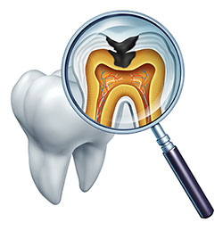 Laurel Bowie Implant and Cosmetic Dentistry | Digital Radiography, Teeth Whitening and Dental Cleanings