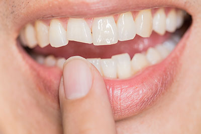 Laurel Bowie Implant and Cosmetic Dentistry | Cosmetic Dentistry, Oral Exams and Extractions