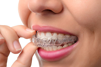 Laurel Bowie Implant and Cosmetic Dentistry | Oral Cancer Screening, Invisalign reg  and Implant Dentistry