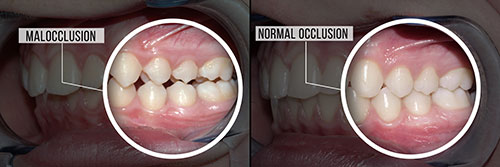 Laurel Bowie Implant and Cosmetic Dentistry | Teeth Whitening, Dental Bridges and Emergency Treatment