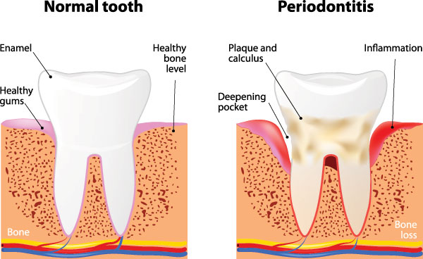 Laurel Bowie Implant and Cosmetic Dentistry | Teeth Whitening, Dental Fillings and Dental Cleanings