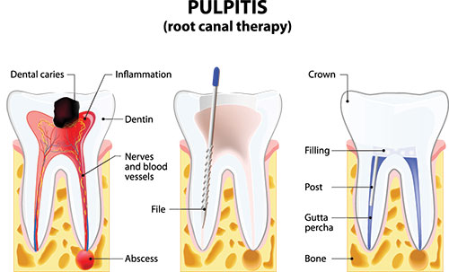 Laurel Bowie Implant and Cosmetic Dentistry | Night Guards, All-on-X and Oral Cancer Screening